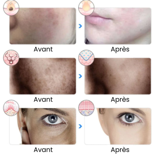 Calmer l'inflammation de la peau du visage : guide complet