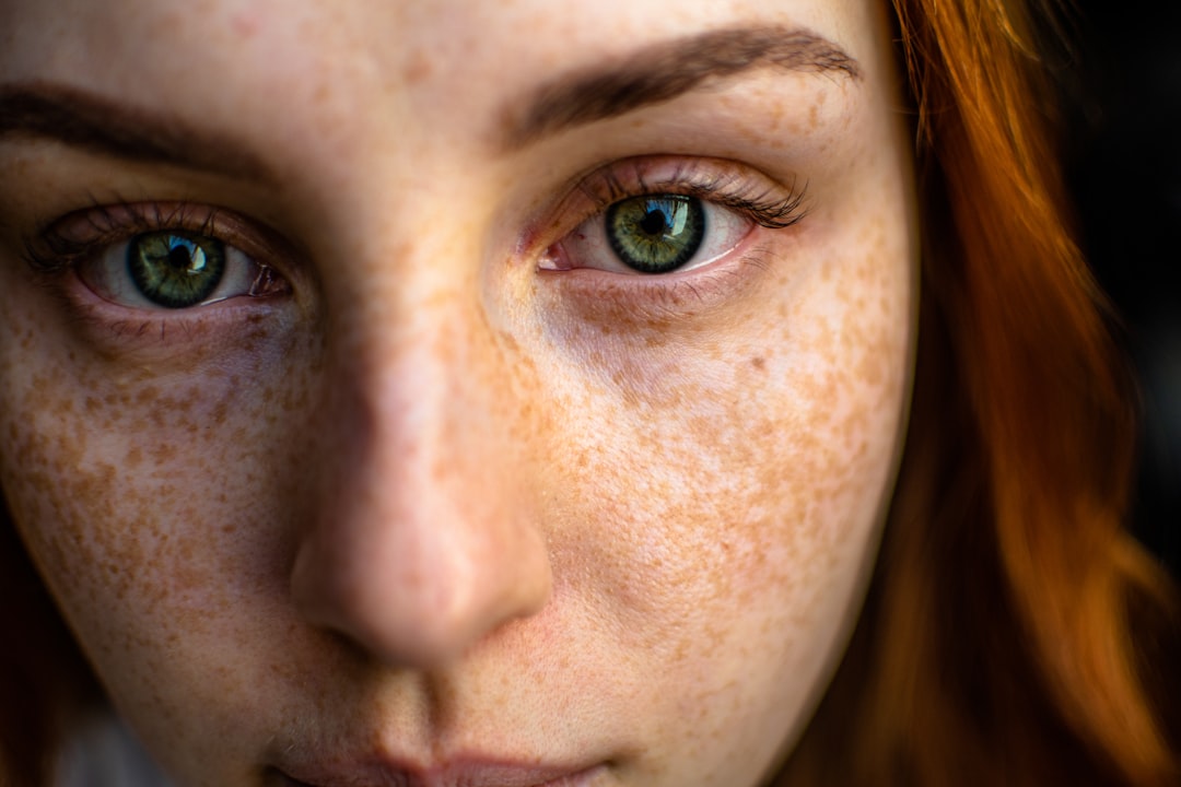 Close-up of a woman's face with freckled skin. The image focuses on the eyes, highlighting the skin's texture discussed in the article about aging and sensitive skin.
