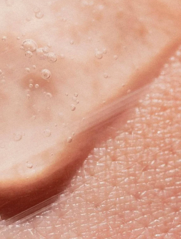 Concentré Peeling AHA - Hydrate et Illumine: fine peau hydratée avec petites bulles visibles sur la surface cutanée.