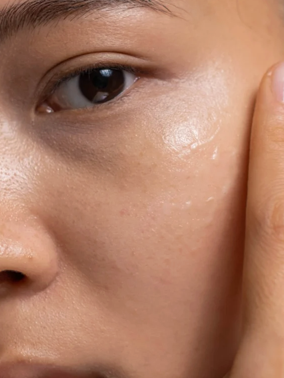 Visage en gros plan: peau hydratée et lumineuse près de la zone des bajoux, montrant une texture douce et repulpée. Gel double hydratation +HA - Lisse et repulpe.