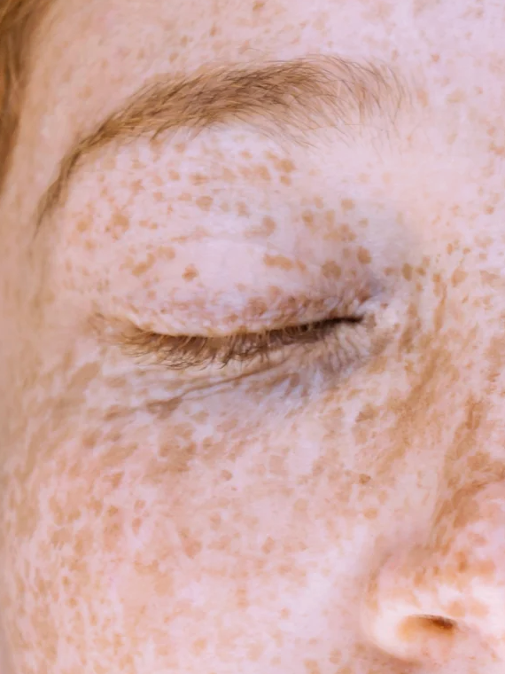 Sérum à la vitamine C