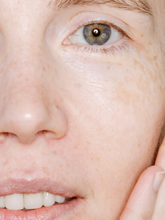 Visage près, peau éclaircie avec quelques taches de soleil et pores visibles; promo: Nettoyant visage éclat radieux.